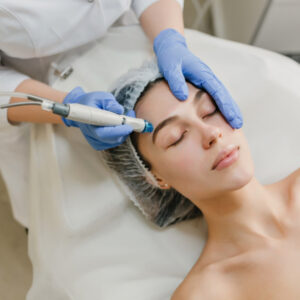Lifting Natural Facial con Tecnología Lipokit